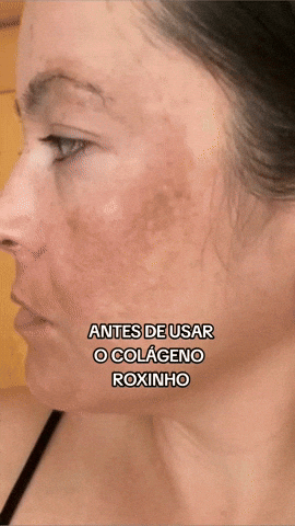 COLAGENO HIDROLIZADO PREMIUN